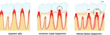 Мобилността на причините за зъби, как да се отнасяме разходите