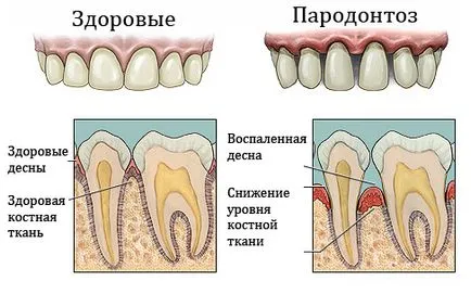 Мобилността на причините за зъби, как да се отнасяме разходите