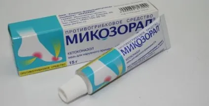 Нігтьової грибок на ногах лікування, як позбутися (ногах) Нігтьової грибок на ногах лікування, як позбутися