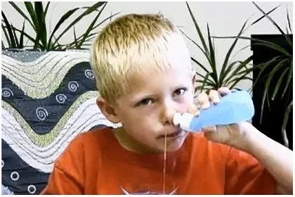 În mod corespunzător se spală nasul copilului în vegetații adenoide