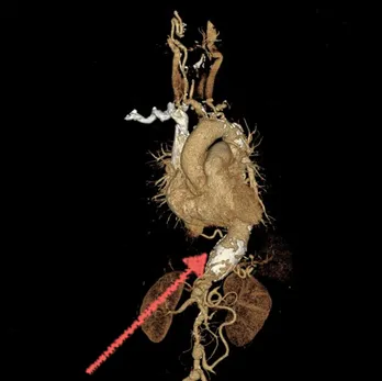 Program megtekintésére MRI, CT és az X-sugarak, a második véleményt