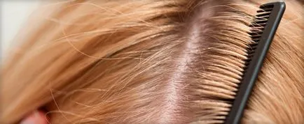 sampon antifungic pentru par si scalp (mikozoral, Nizoral, FITOVAL, sebozol plus keto)