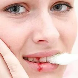 Средствата от кървене на венците изплакване бани и масажи
