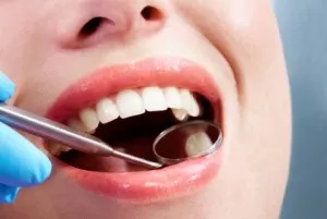 Metode de albirea dinților și curățarea casei - poate fi cel mai bun site pentru stomatologie