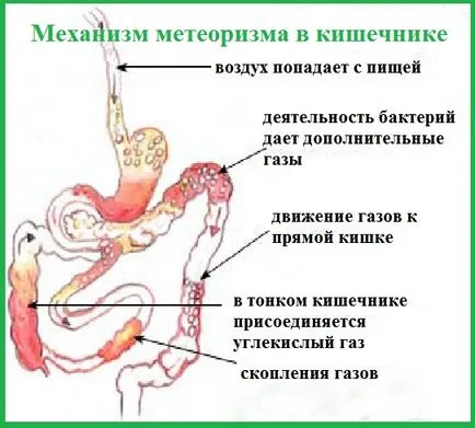 Remedy за подуване на корема и образуване на газ, който е много добър