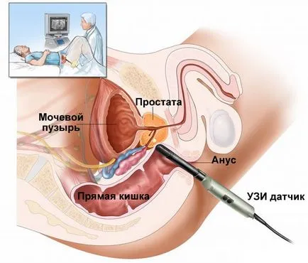 Uzi végbél