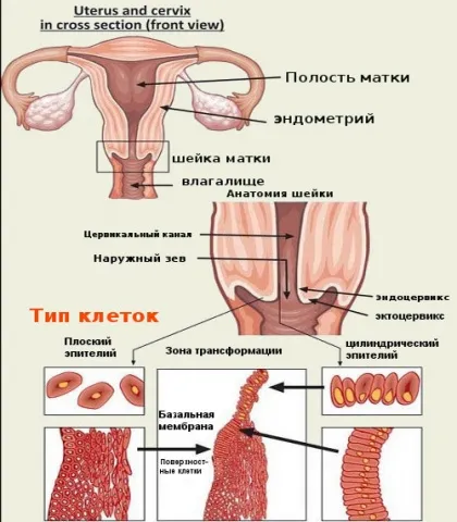 Alocarea de eroziune de col uterin si alte simptome