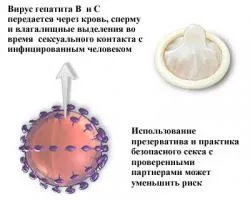 Kérdés, hogy akkor kap hepatitis keresztül óvszer