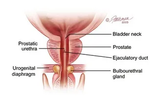 Tratamentul chirurgical al tipurilor de operațiuni prostatita, performanță și gama de echipamente de agrement