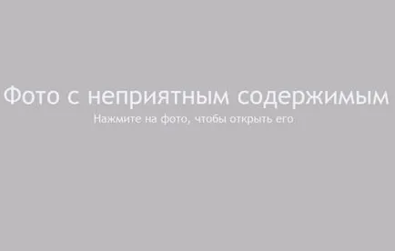 мадама заболяване - пастьорелоза причини, симптоми, курс и лечение на болестта