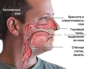 Відчуття закладеності носа але ніс дихає