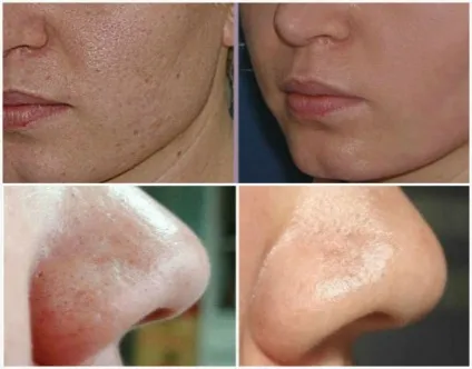 Опис, відгуки та відео про clarisonic mia 2 (clarisonic) Опис, відгуки та відео про clarisonic mia 2