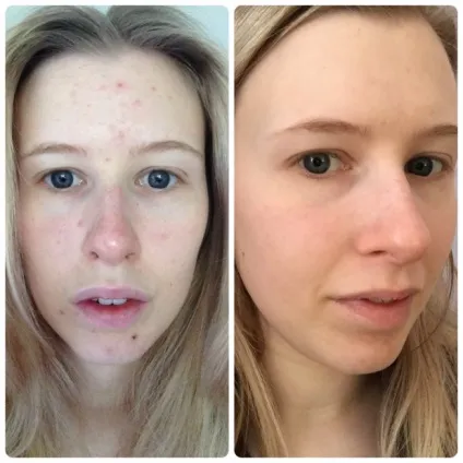 Опис, відгуки та відео про clarisonic mia 2 (очищення особи) Опис, відгуки та відео про clarisonic mia 2