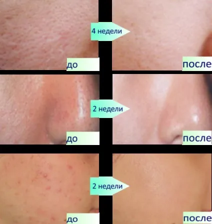Опис, відгуки та відео про clarisonic mia 2 (clarisonic) Опис, відгуки та відео про clarisonic mia 2