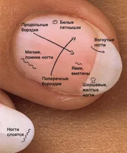 здравето на ноктите - ноктите като показател за здравето на тялото - на красотата и здравето на жените