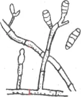 1-vegetatív micélium; 2 - konidienosets; 3 - A bimbók; 4 konídiumok