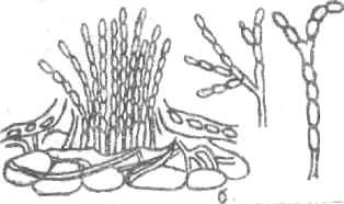1-Вегетативен мицелий; 2 - konidienosets; 3 - филиади; 4 конидии
