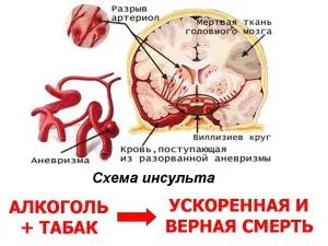 Алкохолът и инсулт, ефектите на алкохола върху развитието на инсулт