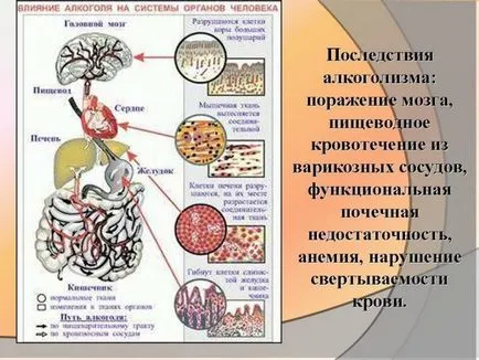 Alcoolul și rinichii de a face în cazul în care după ce a băut rănit rinichi