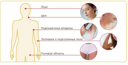 Атопічний дерматит у дорослих симптоми, причини, лікування атопічного дерматиту медикаментозними (причини) Атопічний дерматит у дорослих симптоми, причини, лікування атопічного дерматиту медикаментозними