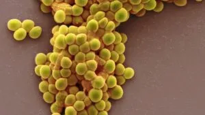 Lactobacillus bulgaricus și Streptococcus valoarea lactobacili termofili