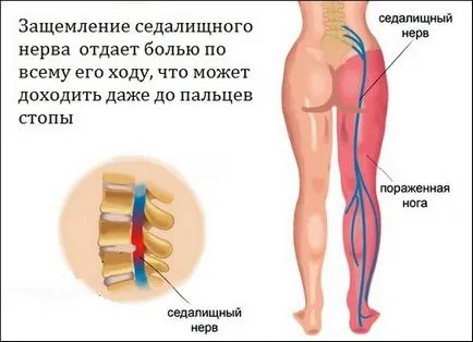 Болки в крака от коляното до подножието причинява болка в предната част, отстрани отзад