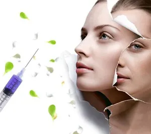 Botox или хиалуронова киселина плюсове и минуси методи