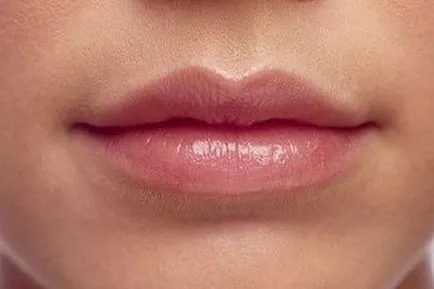buzelor indicații Botox, complicații, cât de mult costurile pentru a face augmentarea buzelor Botox