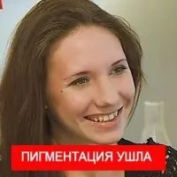 Відбілюючий крем меладерм ціна