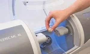 Особливості протезування зубів системою cerec, огляд з цінами (протезування) Особливості протезування зубів системою cerec, огляд з цінами