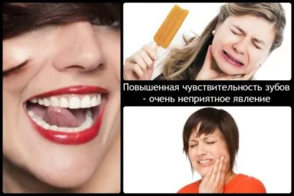 Відбілювання зубів содою і перекисом водню рецепт і відгуки (содою) Відбілювання зубів содою і перекисом водню рецепт і відгуки