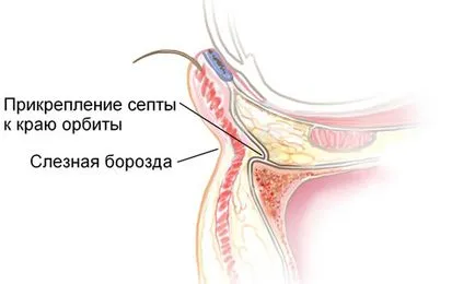 Какво е най-слъзния канал, и това, методи за справяне с него