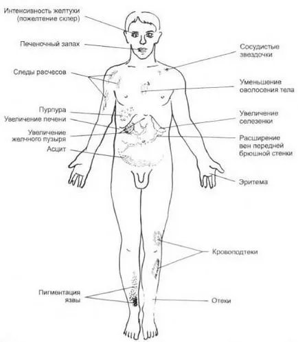 Diagnosticul de icter obstructiv