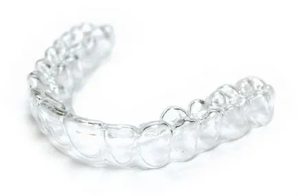 aligner Clear alternativă la aparat dentar