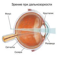 Відгуки про бальзамі для поліпшення зору (зору) Відгуки про бальзамі для поліпшення зору