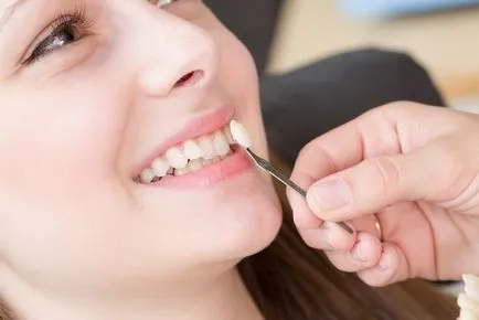 Care este alternativa la aparat dentar decât să le înlocuiască