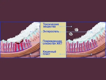 Как да приемате enterosgel