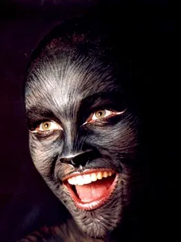 Патології - bodyart, татуювання, пірсинг, тату (татуювання) Патології - bodyart, татуювання, пірсинг, тату