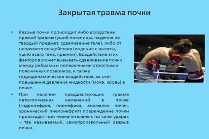 Парапельвікальная кіста нирки причини, діагностика та лікування