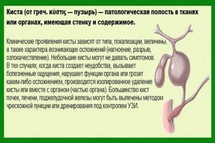 Парапельвікальная кіста нирки причини, діагностика та лікування