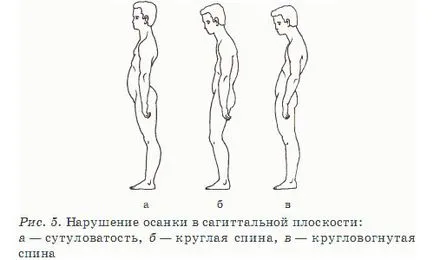 Как да се изправите стойката си човек сам тренировъчна програма