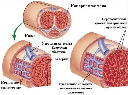 Кавернозен го фиброза