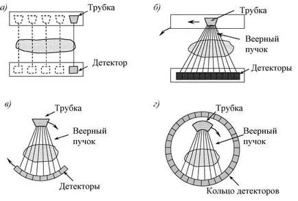 Tomográfia komputertomográfia