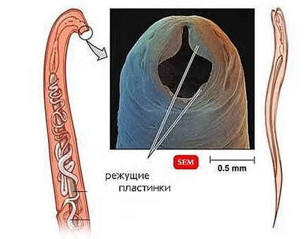 paraziți pielii la oameni