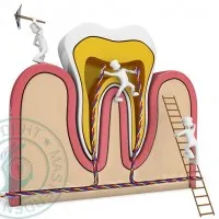 Tratamentul bolii parodontale la prețul de stomatologie, tratament stomatologic