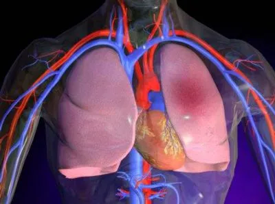 Hipertensiunea pulmonară este ceea ce este și în măsura și motivele pentru diagnostic