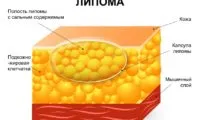 Липом причинява от защо има талк