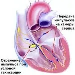 tulburări metabolice în miocard