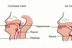 Стравохід і шлунок людини (перший по стравоходу) Стравохід і шлунок людини
