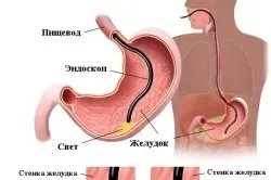 Стравохід і шлунок людини (шлунок) Стравохід і шлунок людини